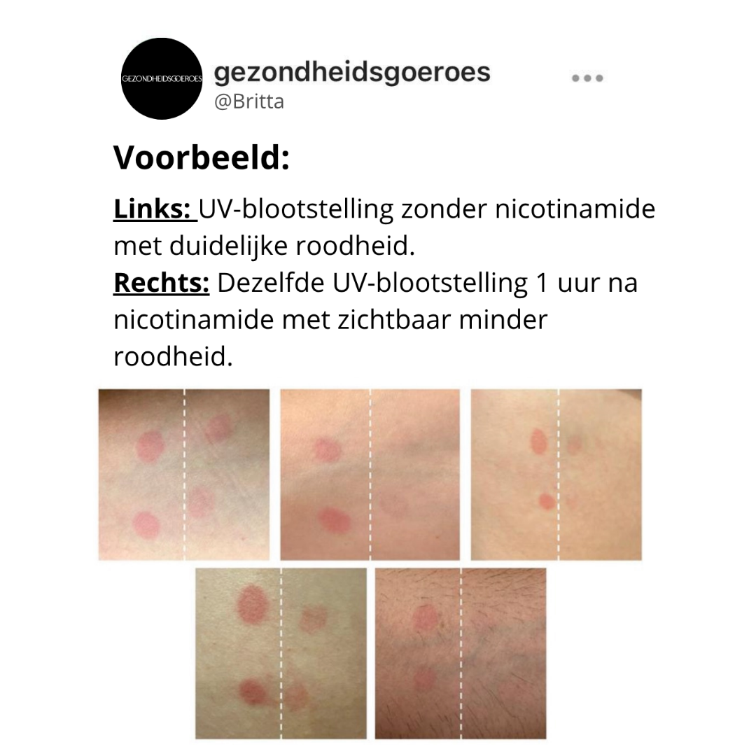 1+1 GRATIS - Sun Support ☀️ bescherming van binnenuit